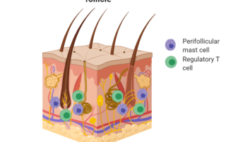 An immune-privileged hair follicle