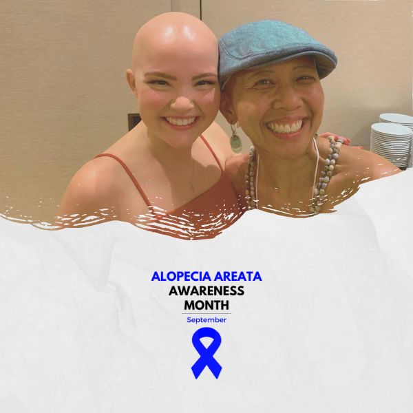 September is Alopecia Areata Awareness Month! Here are ways you can